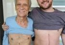 Son who donated part of his liver to his father unfortunately ends up fa… See more
